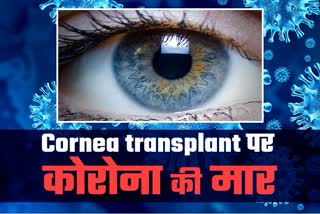 राजस्थान में Cornea transplantion, राजस्थान न्यूज