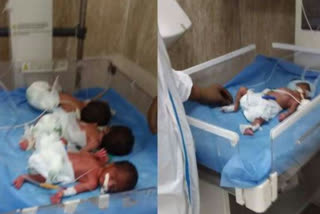 corona infected woman gave birth to 4 child in gorakhpur