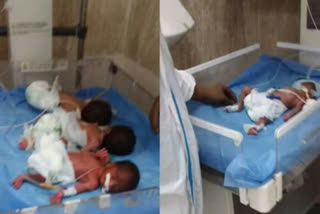 COVID-19 affected woman delivers quadruplets