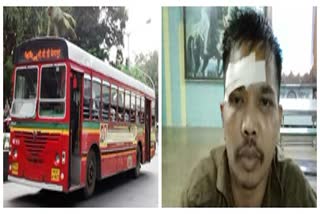 Injured best bus driver
