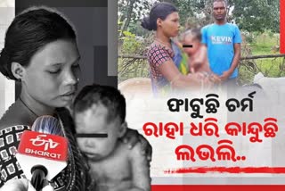 9-yr-girl-infected-with-unknown-skin-disease-need-govt-help-for-treatment-story-land-in-keonjhar