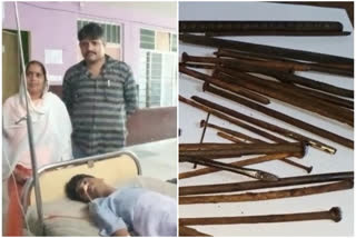 doctors remove 35 iron nails  35 iron nails from man's stomach  35 iron nails in man's stomach  iron pellets in man's stomach  Chandrakusum Hospital  250 grams of iron objects  Unnao doctors remove 35 iron nails  Unnao doctors remove 35 iron nails from man's stomach