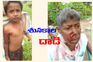 street dogs attack people in warangal urban dist