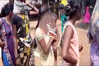 malnourished child increased in palghar district during the lockdown