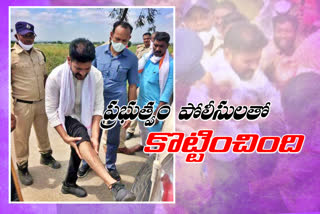 Rewanth Reddy was injured in the leg in Kalvakurthi