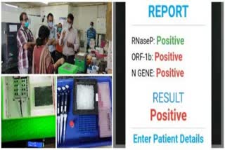 IIT-Kharagpur develops low-cost, portable COVID-19 testing device