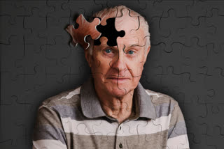 Alzheimer's disease, Alzheimer's study, Memory loss