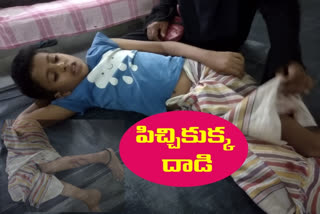 Dog beats children ranmagundam peddapalli district