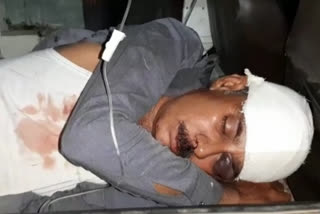 Miscreants attack on local at santipur , nadia