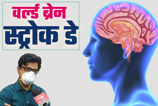 Brain stroke can be fatal know complete information from a well-known doctor sandeep of Chandigarh