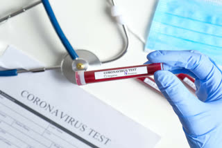 coronavirus test fees in haryana