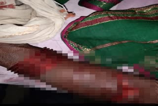 Leopard attack on old women in Jalna