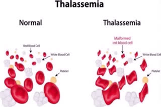 Apna blood bank test blood of thalassemia patients by antibody testing method in palwal