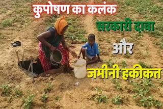 malnutrition free Chhattisgarh