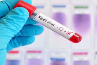 Nipah virus