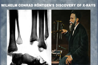 Wilhelm Conrad Röntgen,November 8, 1895 xray discovered