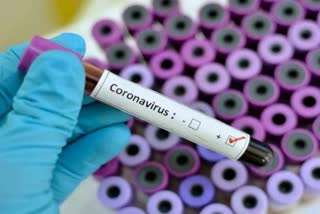 77 new corona patients found in panchkula