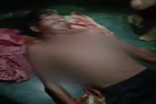 Sister-in-law poured hot water on brother-in-law in Khordha