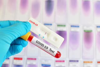 RT-PCR test