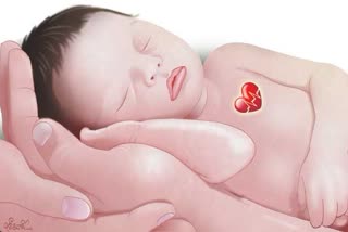 Congenital Heart Disease