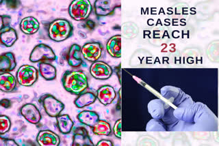 WHO on measles , Measles cases reach 23-year high