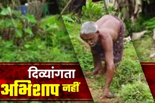 disabled person who succeeded in agriculture