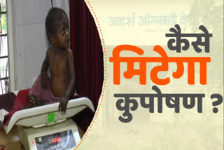 Malnutrition is increasing due to negligence of parents in Alirajpur