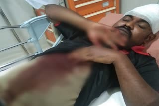 Fatal attack on Cafe Coffee Day Manager in Bangalore
