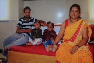 Odisha twin separated through India's 'first' craniopagus surgery dies