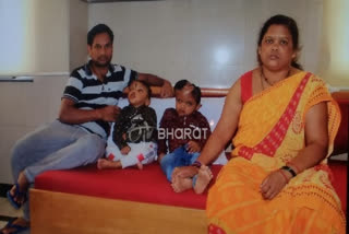 Odisha twin separated through India's 'first' craniopagus surgery dies