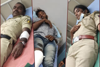 Police firing on robber, Police firing on robber in Bangalore, Bangalore Shootout, Bangalore Shootout news, ದರೋಡೆಕೋರನ ಮೇಲೆ ಗುಂಡಿನ ದಾಳಿ, ಬೆಂಗಳೂರಿನಲ್ಲಿ ದರೋಡೆಕೋರನ ಮೇಲೆ ಗುಂಡಿನ ದಾಳಿ, ಬೆಂಗಳೂರು ಶೂಟೌಟ್​, ಬೆಂಗಳೂರು ಶೂಟೌಟ್​ ಸುದ್ದಿ,