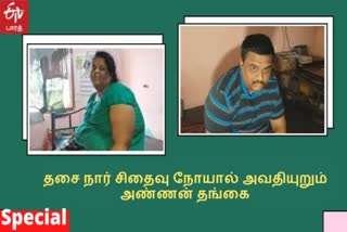 nammakal brother and sister suffered muscular dystrophy