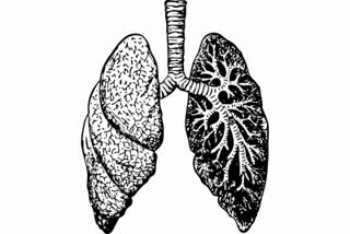 lung fibrosis in Covid patients