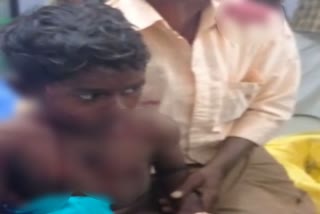 Leopard attack on boy in Koppal district