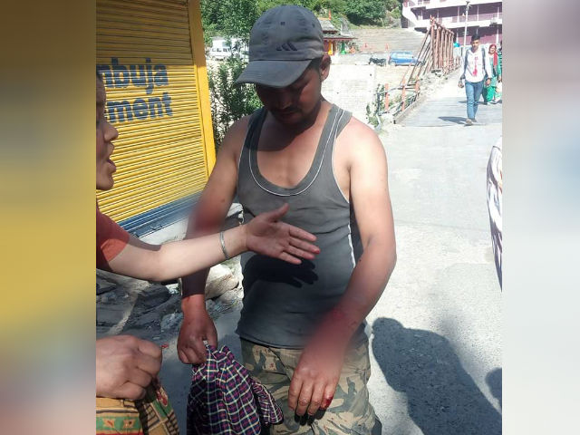 dog bite 11 people in kullu