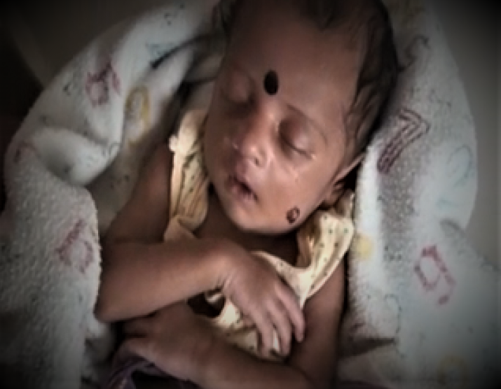 கோயமுத்தூர்  பச்சிளம் குழந்தை  தடுப்பூசி பிரச்சனை  coimbatore  new born baby  Vaccination issuse