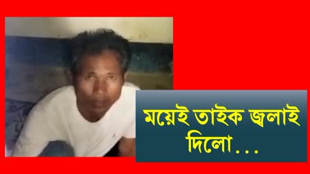 Husband burnt wife in Dima Hasao