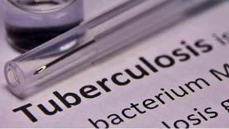 Pediatric TB Found To Affect Lung