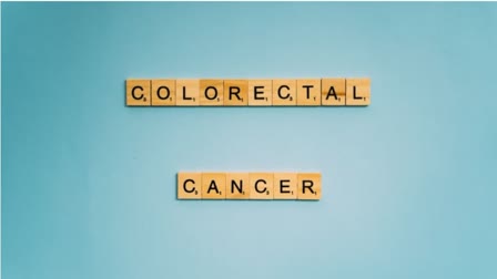 Colorectal Cancer