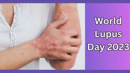 World Lupus Day 2023