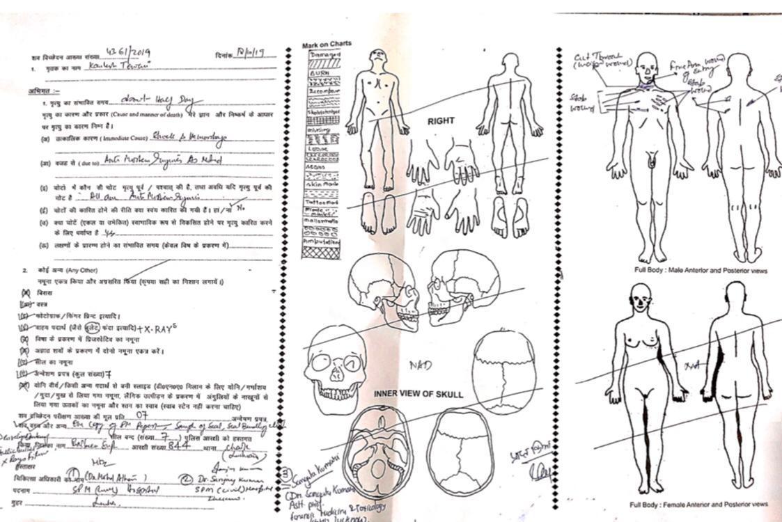 post mortem report of kalmesh tiwari murder case released