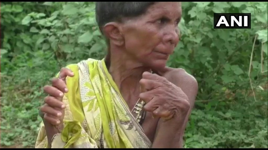 woman born with 20 toes 12 fingers branded a witch forced to stay indoor