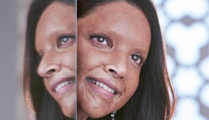 deepika padukone in Chhapaak cinema