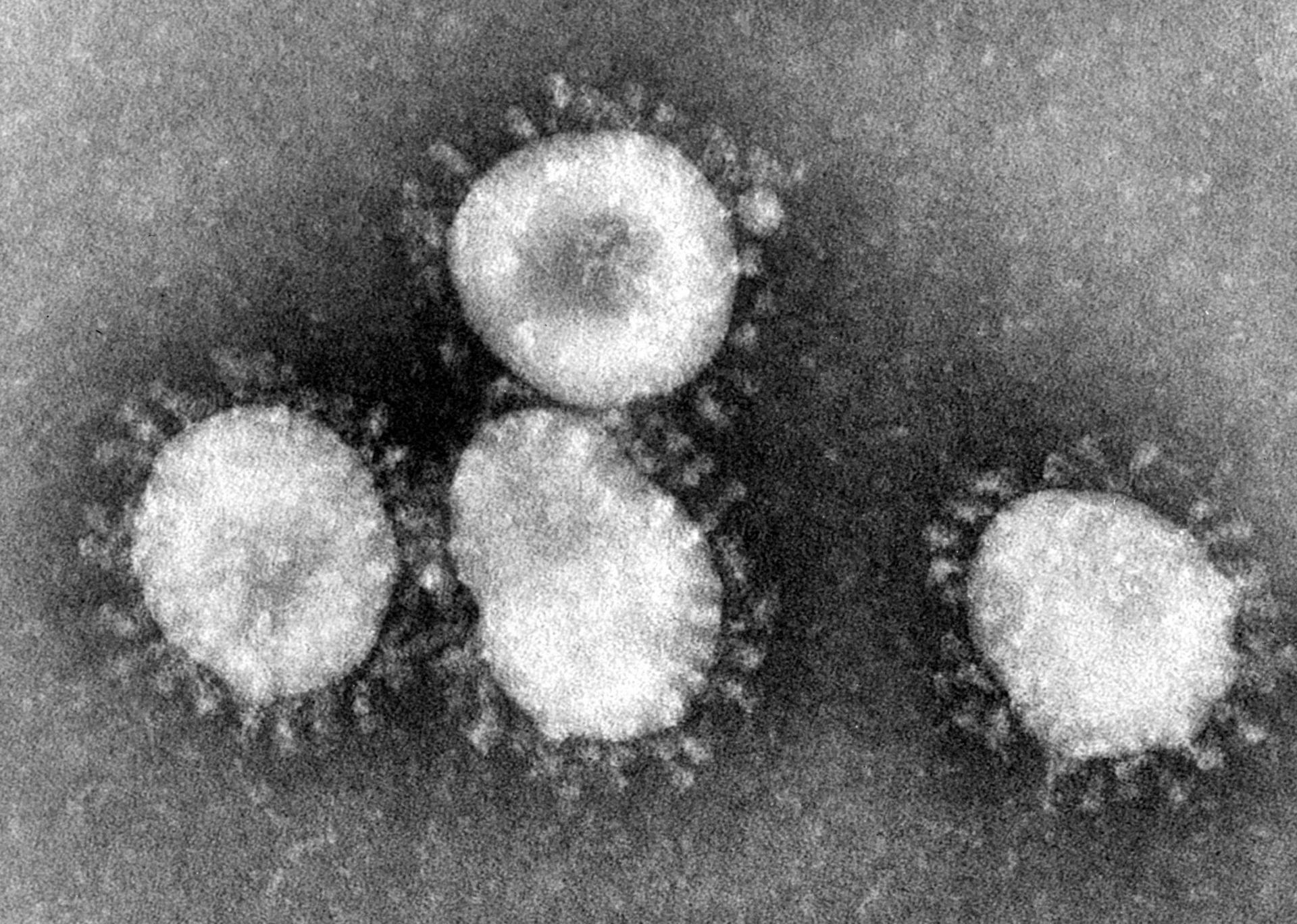 Doctor who warned about Corona Virus