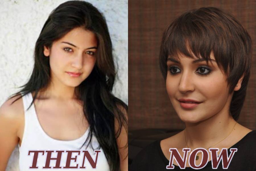 Heroines in Bollywood who swear by Cosmetic Surgery