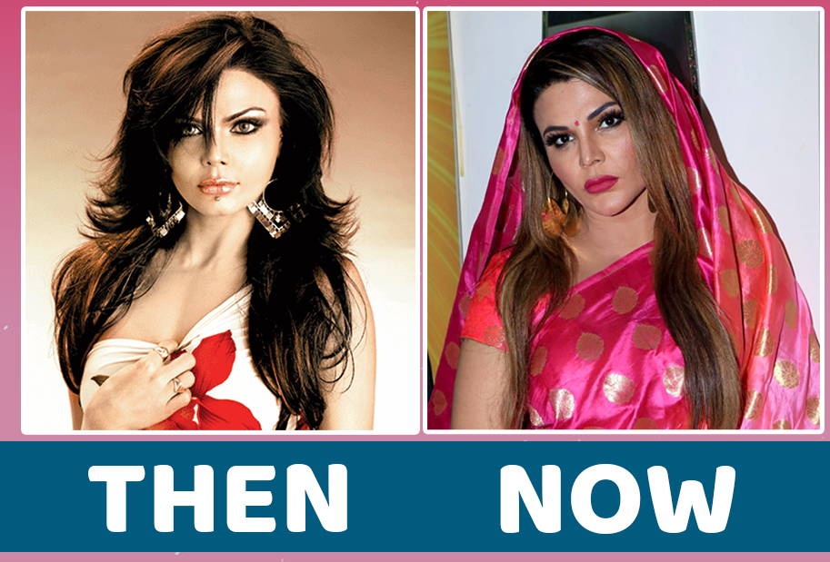 Heroines in Bollywood who swear by Cosmetic Surgery