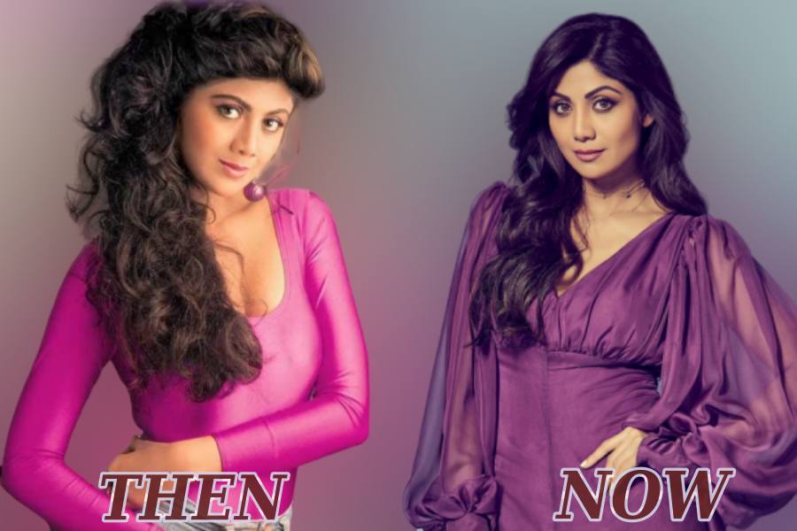 Heroines in Bollywood who swear by Cosmetic Surgery