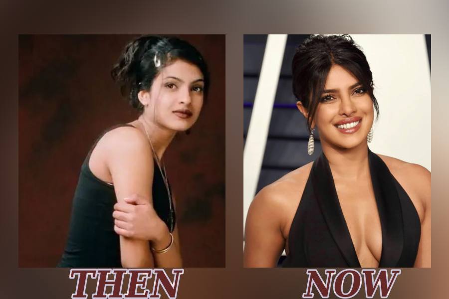 Heroines in Bollywood who swear by Cosmetic Surgery