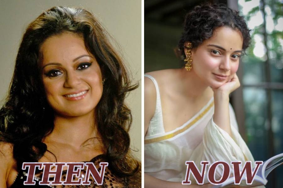 Heroines in Bollywood who swear by Cosmetic Surgery