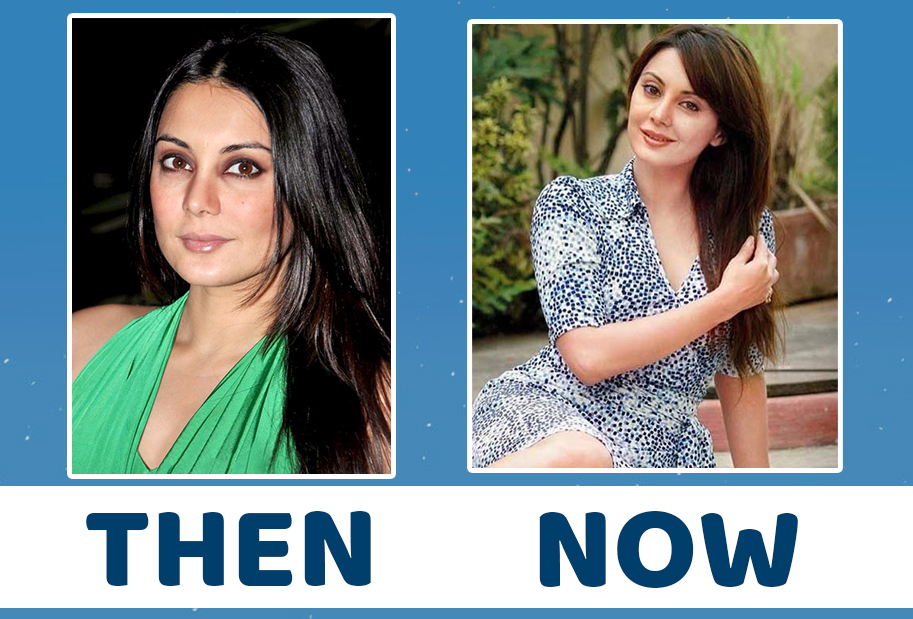 Heroines in Bollywood who swear by Cosmetic Surgery